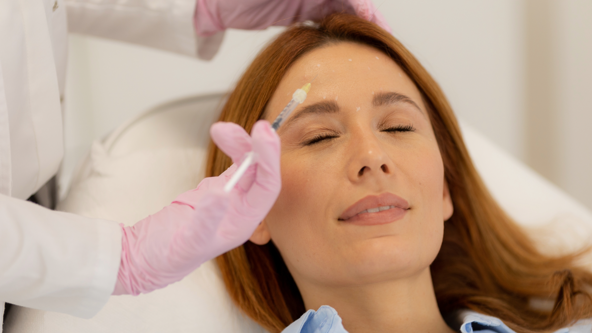 Hyaluronic acid fillers